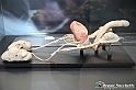 VBS_2567 - Prostata ingrossata - Mostra Body Worlds